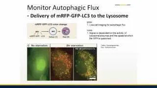 Methods in Autophagy Research (Part1)