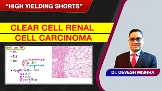 High Yielding Shorts-80 (#HYS-80):Clear Cell Renal Cell Carcinoma by Dr Devesh Mishra