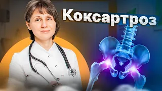 Коксартроз: симптомы, причины, лечение Доктор Лисенкова