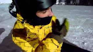 сломал плечо на борде :) fractured shoulder with snowboard