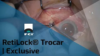 RetiLock®| One-step Autostable Valved Trocar | Features & Procedures | Exclusive | FCI Retina