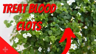 How Do You Treat Blood Clots Naturally ?