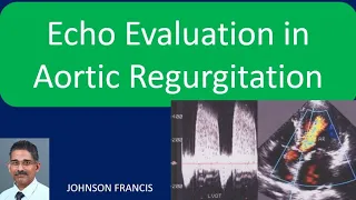 Echo Evaluation in Aortic Regurgitation