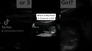 Gender Reveal Ultrasound at 15 Weeks Pregnant!