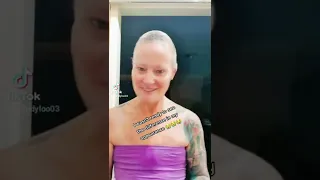My 12th month beating cancer. Hair Growth, Life after Cancer & Returning to work