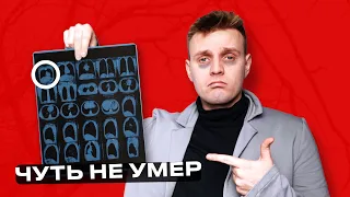 У МЕНЯ НАШЛИ ОПУХОЛЬ, И Я НЕ ШУЧУ