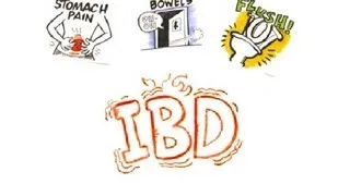 Inflammatory Bowel Disease (IBD)