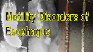 Motility Disorders of Esophagus