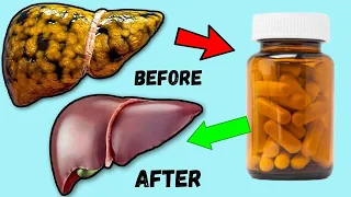 Best Vitamin For Liver Cleansing - Dr. Vivek Joshi