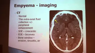 Infectious Diseases Of The CNS - Ayelet ERAN Part 1