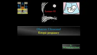 Obstetric Ultrasound -Lecture 03 -Ectopic pregnancy