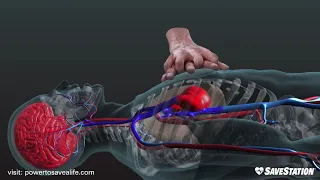 CPR in Action | A 3D look inside the body