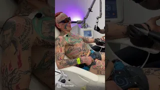 Дед в 72 начал забивать татуировками всё тело, а в 76 лет решил опробовать на себе удаление тату