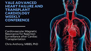 Cardiovascular Magnetic Resonance for Rejection Surveillance after Cardiac Transplantation