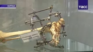 Ученые создают автоматический аппарат Илизарова, который в два раза ускоряет рост костей