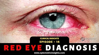 How to Diagnose the Red Eye - Episode 14