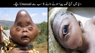 8 Most Unusual Kids Ever Born On Earth | دنیا کے سب سے انوکھے بچے | Haider Tv