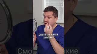 Носогубные складки есть?