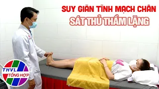 Sức khỏe của bạn: Suy giãn tĩnh mạch chân - Sát thủ thầm lặng