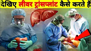 देखिए एक इंसान का लीवर निकालकर दूसरे के शरीर में कैसे डालते है | How Does Liver Transplant Works?