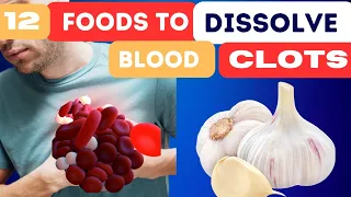 12 Foods That Naturally Dissolve Blood Clots for Optimal Cardiovascular Health!"