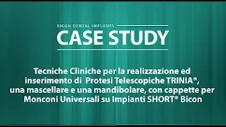 Realizzazione ed Inserimento di  Protesi Telescopiche in TRINIA® mascellare e mandibolare