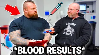 I Had My Bloods Tested… HERE ARE THE RESULTS! (INFORMATIVE)