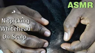 ASMR Nitpicking Whiteheads💆🏼‍♀️ On Scalp || Scalp Check up