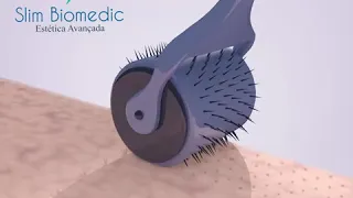 Animação 3D Microagulhamento Roller