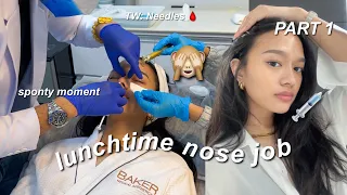 Getting a Hiko Nose Thread Lift! *SCARY BA?* (The Procedure) | Part 1/2