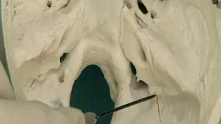 1.14 Step 23.  Foramina of the posterior cranial fossa