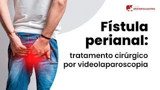 Fístula perianal: tratamento cirúrgico por videolaparoscopia | Clínica Hepatogastro