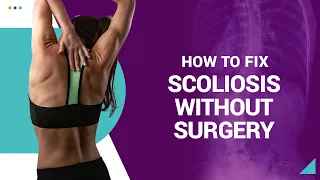 How to Fix Scoliosis Without Surgery
