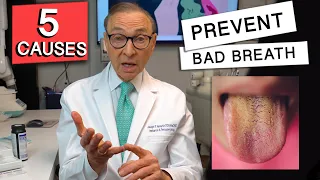 Top 5 CAUSES of BAD BREATH | How to Prevent it!