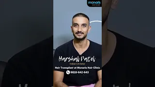 Harshal Patel (Indian Cricketer) Hair Transplant at Monaris Hair Clinic by Dr. Arihant Surana