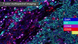 PerkinElmer - 7-Color Multispectral Imaging with Vectra Polaris