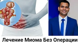 Лечение Миома Без Операции.