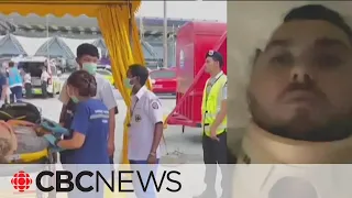 Severe turbulence, emergency landing were 'surreal,' injured Singapore Airlines passenger says