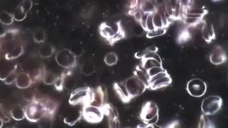Live virus - Живой Вирус под микроскопом
