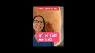 Scabs: Wound Care | @LevelUpRN