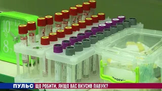 Що робити, якщо вас вкусив павук. Випуск від 19.05.2021