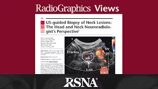 US-guided Biopsy of Neck Lesions: The Head and Neck Neuroradiologist’s Perspective