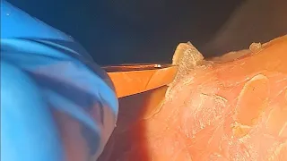 Foot Peeling Feeling 2