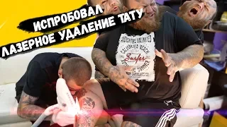 Лазер ПРОТИВ тату | лазерное удаление | как УДАЛИТЬ татуировку