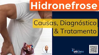 Hidronefrose (Rim Dilatado) | Como diagnosticar e tratar?