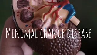 Minimal Change Disease | The White Army