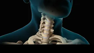 😱Neck Surgery | Cervical Unique  surgery Discectomy | Nucleus Health 😱