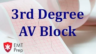 3rd Degree AV Block ECG - EMTprep.com