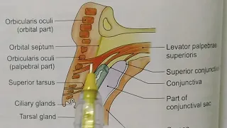 EYELIDS OR PALPEBRAE ANATOMY-NOTES#B.D.CHAURASIA#HEAD,NECK AND BRAIN ANATOMY