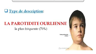 Les Oreillons   Dr Benzoubara Infectieux   4ème année médecine